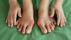 足の指の関節痛にいつも悩まされていませんか?専門家が永久に解消する方法を解説
